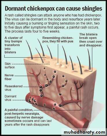 Pertusis and Varicella