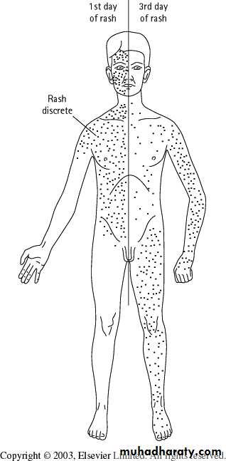 Pertusis and Varicella