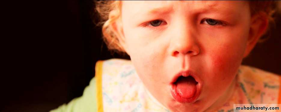 Pertusis and Varicella