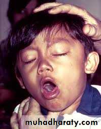 Pertusis and Varicella