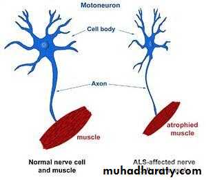 ALS and DEmntia