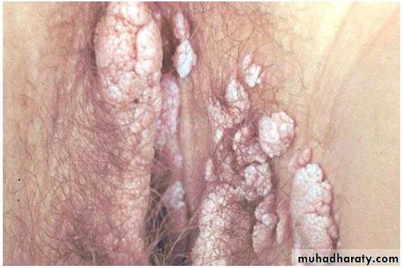 disease of vulva 2