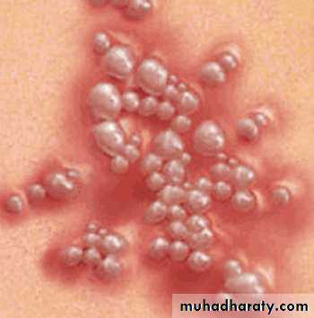 disease of vulva 2
