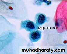 Cervical dysplasia
