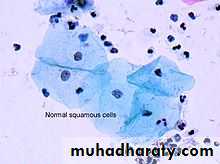 Cervical dysplasia slides