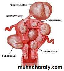 Cervical dysplasia slides