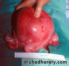 Cervical dysplasia slides