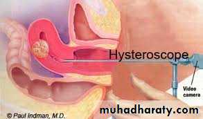 Cervical dysplasia slides