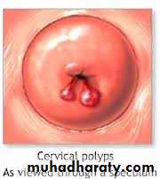Cervical dysplasia slides