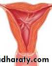 Cervical dysplasia slides