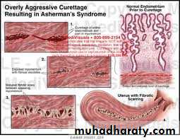 Cervical dysplasia slides