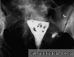 Cervical dysplasia slides