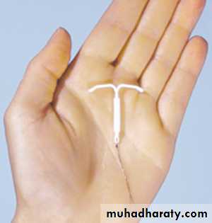 CONTRACEPTION
