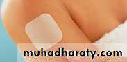 CONTRACEPTION