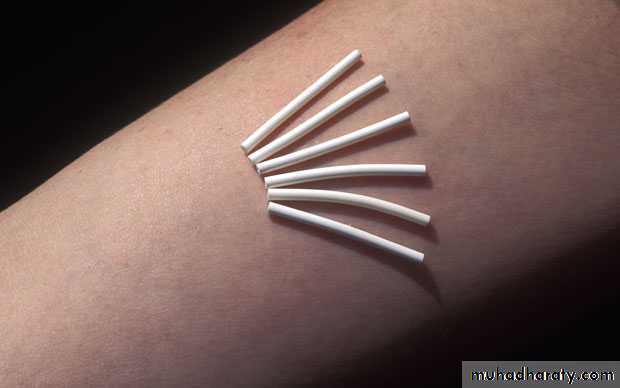 CONTRACEPTION