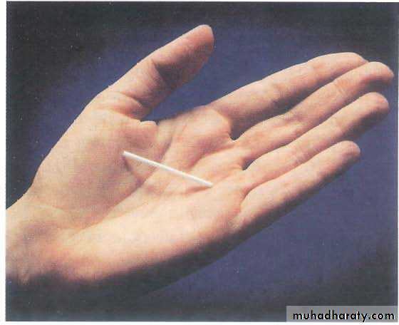 CONTRACEPTION