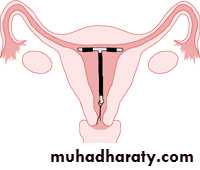 CONTRACEPTION