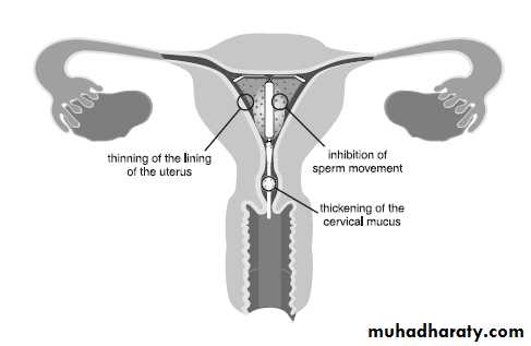 CONTRACEPTION