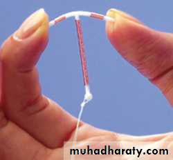 CONTRACEPTION