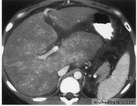 Endoscopic GIT