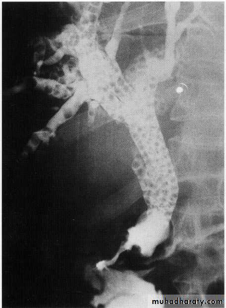 Endoscopic GIT