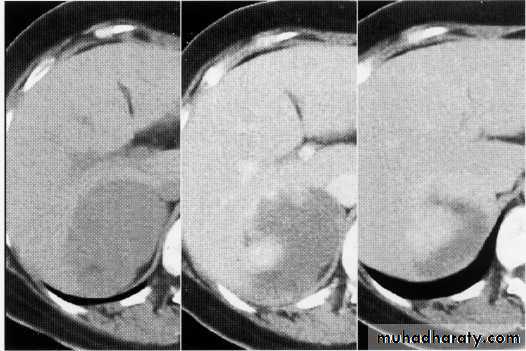 Endoscopic GIT
