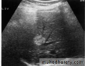 Endoscopic GIT