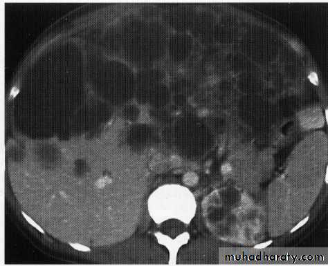 Endoscopic GIT