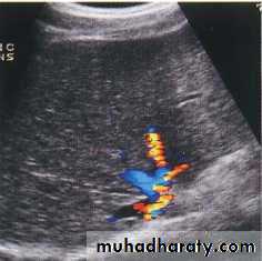 Endoscopic GIT