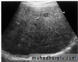 Endoscopic GIT