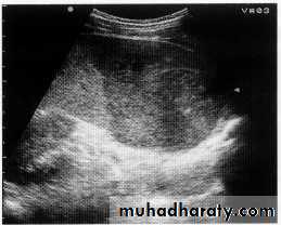Endoscopic GIT