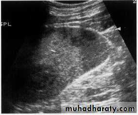 Endoscopic GIT