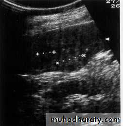 Endoscopic GIT