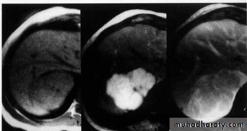 Endoscopic GIT