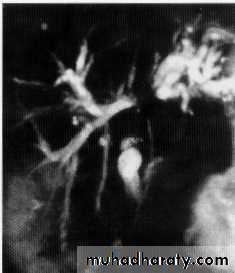 Endoscopic GIT