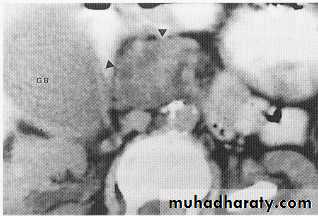 Endoscopic GIT