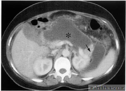 Endoscopic GIT