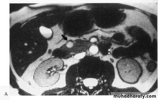 Endoscopic GIT