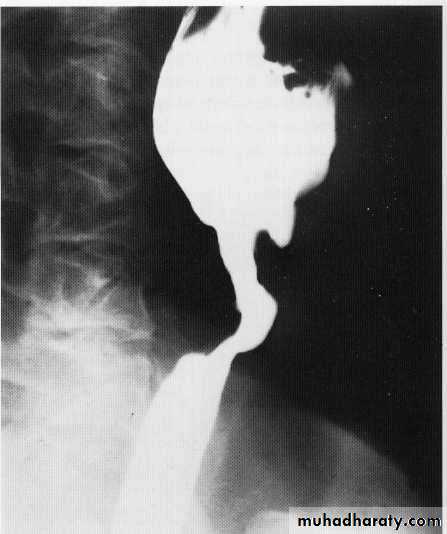 Endoscopic GIT