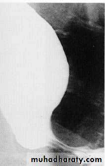 Endoscopic GIT