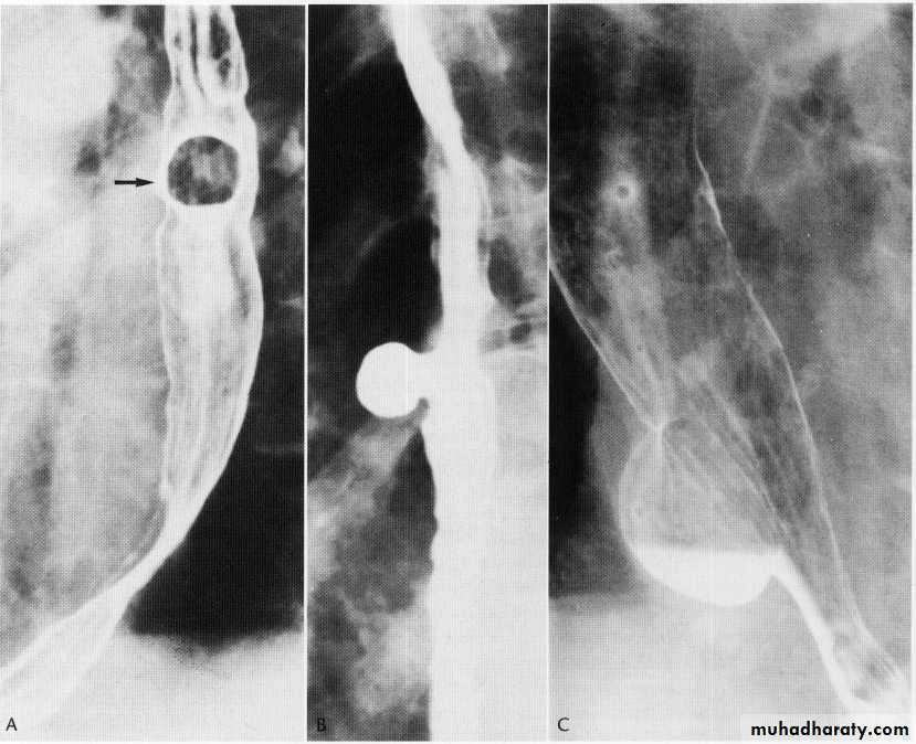 Endoscopic GIT
