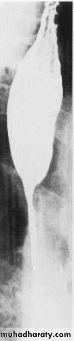 Endoscopic GIT