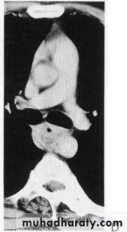Endoscopic GIT