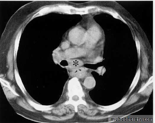 Endoscopic GIT