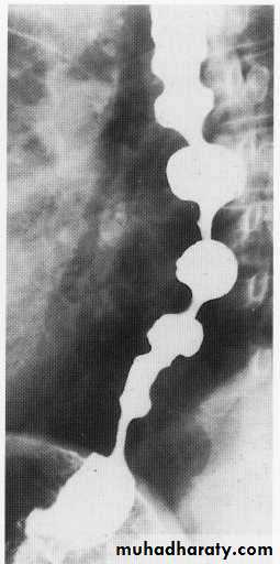 Endoscopic GIT