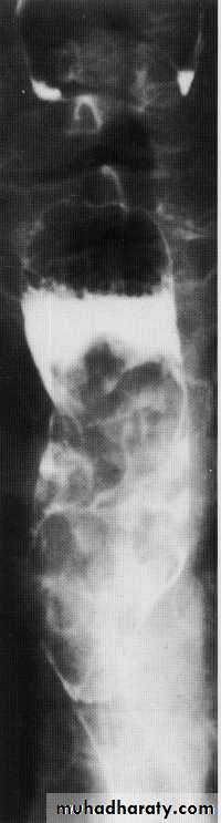 Endoscopic GIT