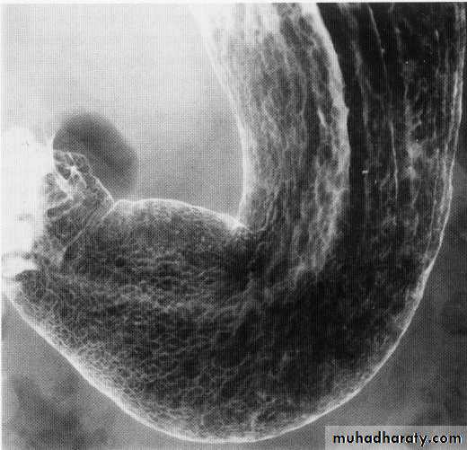 Endoscopic GIT