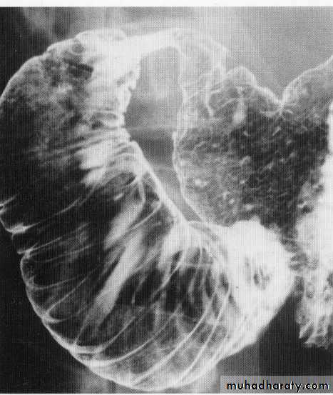 Endoscopic GIT