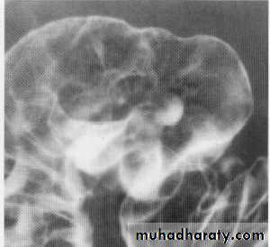 Endoscopic GIT