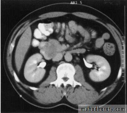 Endoscopic GIT